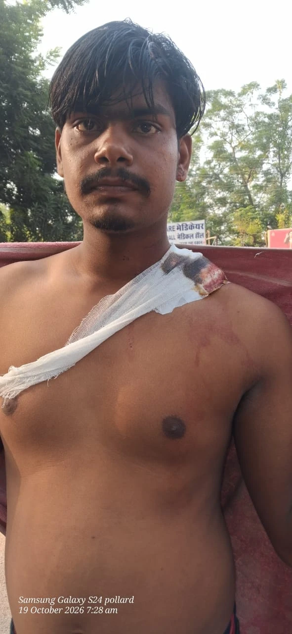 सुल्तानगंज फोरलेन पर बदमाशों का कहर , लूटपाट के बाद युवक को मारी गोली
